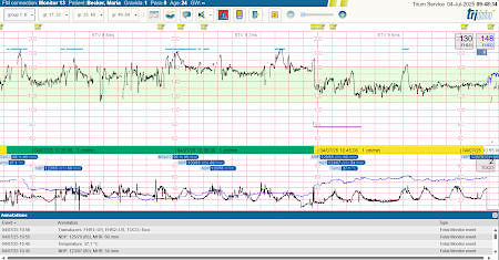 Trium CTG Online 3.0 screenshot