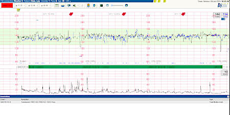 Trium CTG Online 3.0 screenshot
